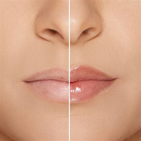 lip injection maximum plump|More.